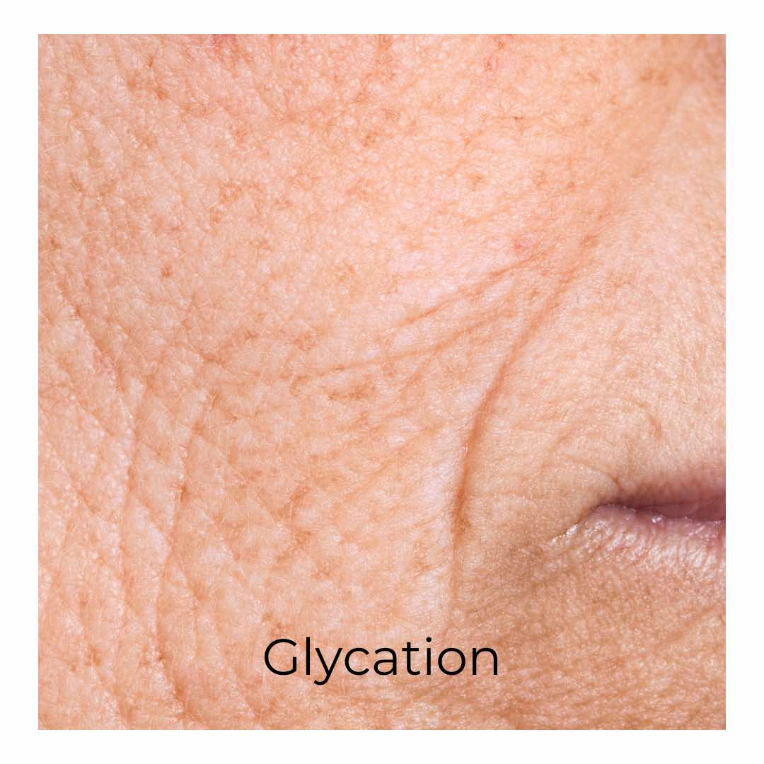 Glycation