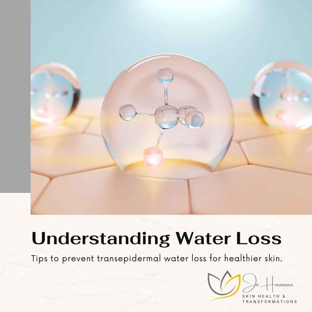 Understanding water loss